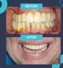 Ordinacija dentalne medicine Aleksandar Kovačević, dr.med.dent.