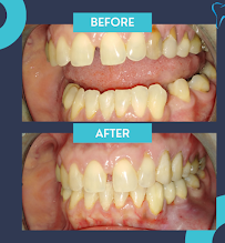 Ordinacija dentalne medicine Aleksandar Kovačević, dr.med.dent.