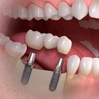 Thantakit International Dental Center in Bangkok, Thailand