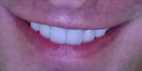 SmileBox Dental Clinic Thonglor Sukhumvit คลินิกทันตกรรมสไมล์บ็อกซ์ ทองหล่อ สุขุมวิท