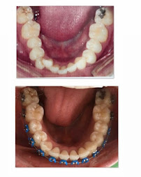 Odontología en Bogotá l Ortodoncia l Ortodoncia invisible l Dentist l Smile design l Doctor Granados