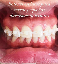 Odontología en Bogotá l Ortodoncia l Ortodoncia invisible l Dentist l Smile design l Doctor Granados