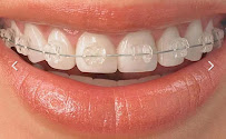 Odontología en Bogotá l Ortodoncia l Ortodoncia invisible l Dentist l Smile design l Doctor Granados