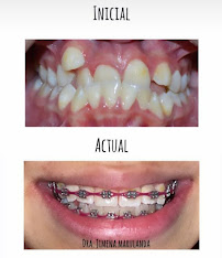 Odontología en Bogotá l Ortodoncia l Ortodoncia invisible l Dentist l Smile design l Doctor Granados