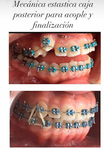 Odontología en Bogotá l Ortodoncia l Ortodoncia invisible l Dentist l Smile design l Doctor Granados