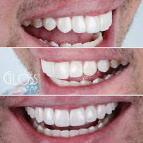 GLOSS DENT Bogotá – Odontología Estética