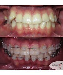 ARTEK ODONTOLOGIA LASER - ODONTOLOGIA COMFORTABLE - ORTODONCIA