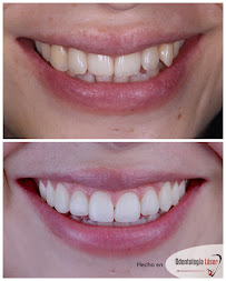 ARTEK ODONTOLOGIA LASER - ODONTOLOGIA COMFORTABLE - ORTODONCIA