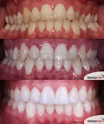 ARTEK ODONTOLOGIA LASER - ODONTOLOGIA COMFORTABLE - ORTODONCIA