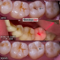 ARTEK ODONTOLOGIA LASER - ODONTOLOGIA COMFORTABLE - ORTODONCIA