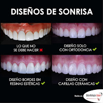 ARTEK ODONTOLOGIA LASER - ODONTOLOGIA COMFORTABLE - ORTODONCIA