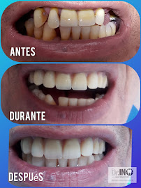 Clinica Odontologica Dr. IN, Odontologia especializada Chapinero