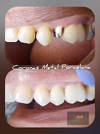 Clinica Odontologica Dr. IN, Odontologia especializada Chapinero