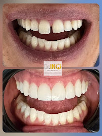 Clinica Odontologica Dr. IN, Odontologia especializada Chapinero