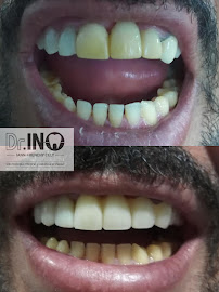 Clinica Odontologica Dr. IN, Odontologia especializada Chapinero