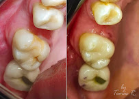 Odontología en Bogotá l Aclaramiento dental l Ortodoncia en Bogotá l Ortodoncia l limpieza dental l Clinica Dentu
