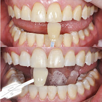 Odontología en Bogotá l Aclaramiento dental l Ortodoncia en Bogotá l Ortodoncia l limpieza dental l Clinica Dentu