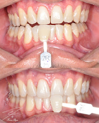 Odontología en Bogotá l Aclaramiento dental l Ortodoncia en Bogotá l Ortodoncia l limpieza dental l Clinica Dentu