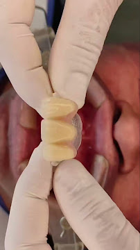 Odontología en Bogotá l Aclaramiento dental l Ortodoncia en Bogotá l Ortodoncia l limpieza dental l Clinica Dentu