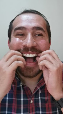 Odontología en Bogotá l Aclaramiento dental l Ortodoncia en Bogotá l Ortodoncia l limpieza dental l Clinica Dentu