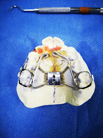 Odontología en Bogotá l Aclaramiento dental l Ortodoncia en Bogotá l Ortodoncia l limpieza dental l Clinica Dentu