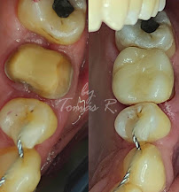 Odontología en Bogotá l Aclaramiento dental l Ortodoncia en Bogotá l Ortodoncia l limpieza dental l Clinica Dentu
