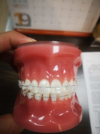Odontología en Bogotá l Aclaramiento dental l Ortodoncia en Bogotá l Ortodoncia l limpieza dental l Clinica Dentu