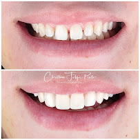 Dr. Christian Felipe Pinto | Odontología en Bogotá l Diseño de sonrisa | Dentist | Implantes Dentales | Prótesis Dentales