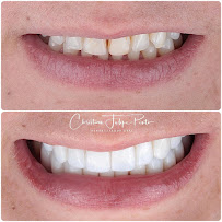 Dr. Christian Felipe Pinto | Odontología en Bogotá l Diseño de sonrisa | Dentist | Implantes Dentales | Prótesis Dentales