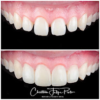 Dr. Christian Felipe Pinto | Odontología en Bogotá l Diseño de sonrisa | Dentist | Implantes Dentales | Prótesis Dentales