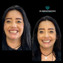 Dr. Christian Felipe Pinto | Odontología en Bogotá l Diseño de sonrisa | Dentist | Implantes Dentales | Prótesis Dentales