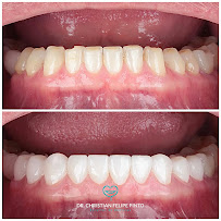 Dr. Christian Felipe Pinto | Odontología en Bogotá l Diseño de sonrisa | Dentist | Implantes Dentales | Prótesis Dentales