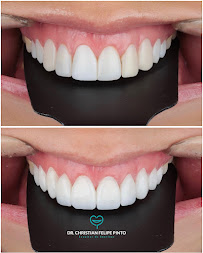 Dr. Christian Felipe Pinto | Odontología en Bogotá l Diseño de sonrisa | Dentist | Implantes Dentales | Prótesis Dentales