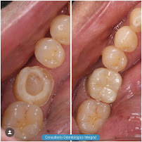 Consultorio Odontológico Integral, Ortodoncia, Rx periapical, Financiacion de tratamiento, Galerias Chapinero Bogota