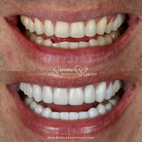 Dr Nelson Serrano Odontologia Premium