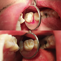 Dra Amdie Chirinos - Endodoncista en Bogotá