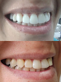 Dra. Luz Orozco - Dentista Bogotá