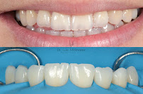 Periodoncia y Rehabilitación Oral - SIAN Dental Care