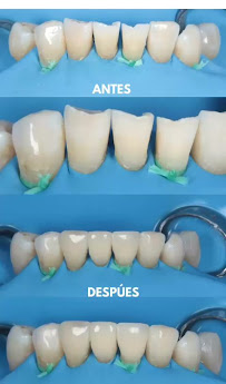 Periodoncia y Rehabilitación Oral - SIAN Dental Care