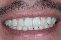 Periodoncia y Rehabilitación Oral - SIAN Dental Care