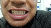 Odontologia GALERIAS, english spoken invisalign, ortodoncia invisibleDRA MARTHA GALARZA,