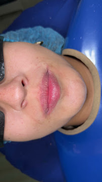 Odontología Estética en Teusaquillo Bogotá | Dra Daniela Pino