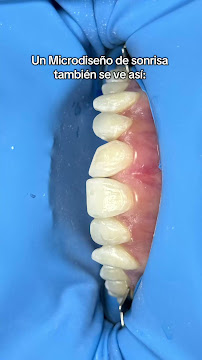 Odontología Estética en Teusaquillo Bogotá | Dra Daniela Pino