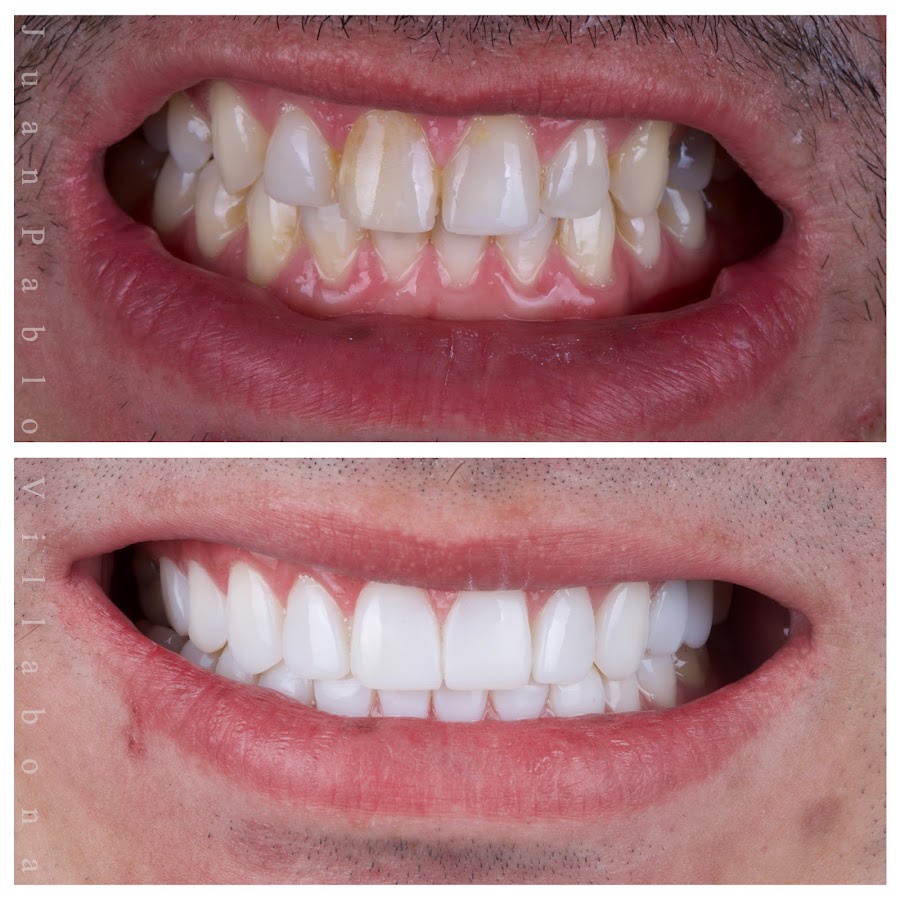 DR JUAN PABLO VILLABONA - ODONTOLOGO ESTETICO - DISEÑO DE SONRISA - Bogotá D.C - dental clinic in Bogota, Colombia