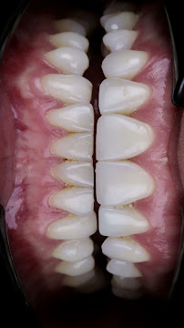 DR JUAN PABLO VILLABONA - ODONTOLOGO ESTETICO - DISEÑO DE SONRISA - Bogotá D.C