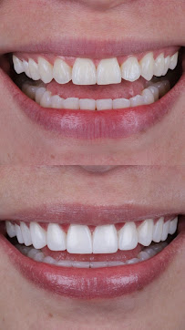 DR JUAN PABLO VILLABONA - ODONTOLOGO ESTETICO - DISEÑO DE SONRISA - Bogotá D.C