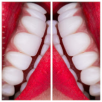 DR JUAN PABLO VILLABONA - ODONTOLOGO ESTETICO - DISEÑO DE SONRISA - Bogotá D.C