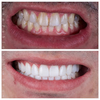 DR JUAN PABLO VILLABONA - ODONTOLOGO ESTETICO - DISEÑO DE SONRISA - Bogotá D.C in Bogota