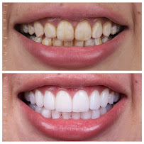 DR JUAN PABLO VILLABONA - ODONTOLOGO ESTETICO - DISEÑO DE SONRISA - Bogotá D.C