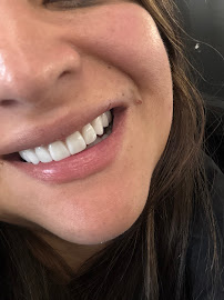 DR JUAN PABLO VILLABONA - ODONTOLOGO ESTETICO - DISEÑO DE SONRISA - Bogotá D.C